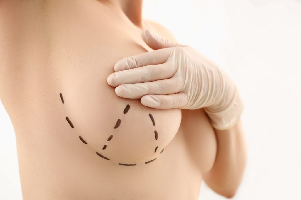 Breast Enlargement in Turkey